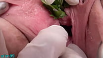 porn motherlesscom nettles in peehole urethral insertion nettles fisting cunt porn