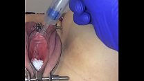 porn xxx female catheter tutorial porn