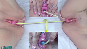 porn lésbicas com prolapso do colo do útero ao mesmo tempo porn